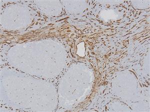 3176B | Control Slides:Immunopathology; CD34